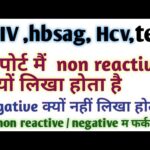 Hiv 0,08 no reactiva