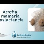 Atrofia mamaria
