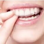 Brillante Sonrisa en Casa: Blanqueamiento Dental